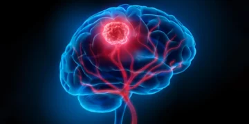 Researchers uncover how physical force slows cancer growth