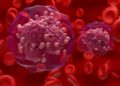 Researchers propose new drugs to improve treatment for rare infant leukaemia