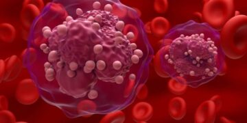 Researchers propose new drugs to improve treatment for rare infant leukaemia