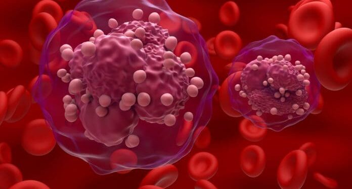 Researchers propose new drugs to improve treatment for rare infant leukaemia
