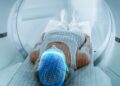 Second PSMA PET scan finds hidden prostate cancer in 56% of patients