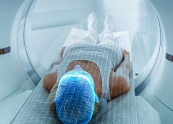 Second PSMA PET scan finds hidden prostate cancer in 56% of patients
