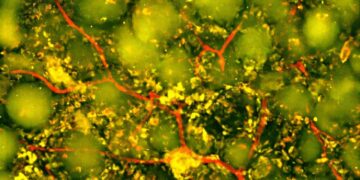 Study finds new stroke treatment with injectable biomaterial